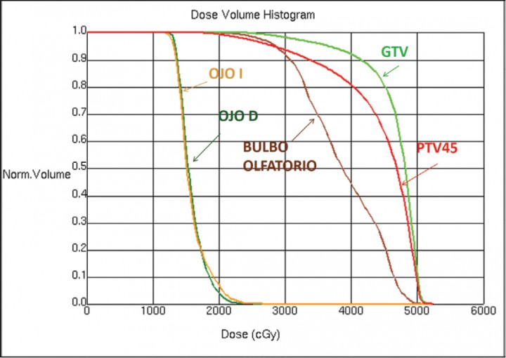 <p>Histogramas dosis volumen, que muestran la dosis total de radiación recibida en el volumen planificado de tratamiento (PTV), volumen tumoral macroscópico (GTV) y órganos de riesgo.</p>