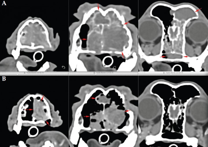 <p>Imagen en TC post-contraste en plano transversal y ventana de tejido blando. (A) Al inicio del tratamiento con radioterapia. (B) A los 3 meses del tratamiento, donde se observa una marcada reducción del volumen tumoral.</p>