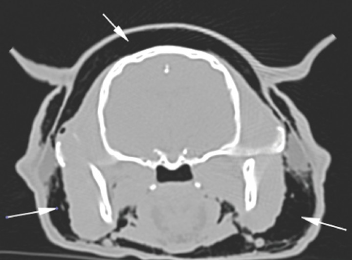 <p>Corte transversal a nivel de la cabeza en ventana hueso. Las fechas blancas señalan enfisema subcutáneo.</p>