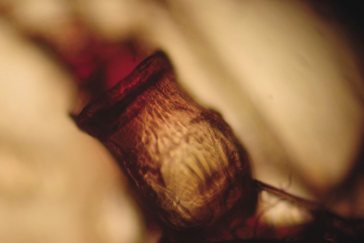 <p>Cutícula larval extraída por raspado profundo.</p>