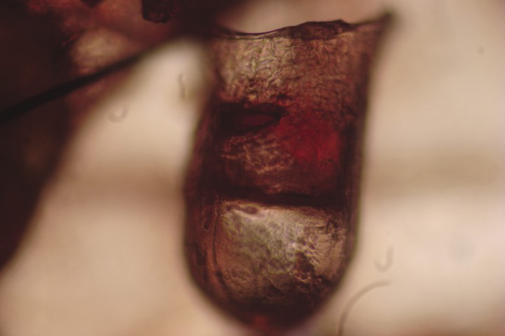 <p>Cutícula larval extraída por raspado profundo. Obsérvese la larva en su interior.</p>