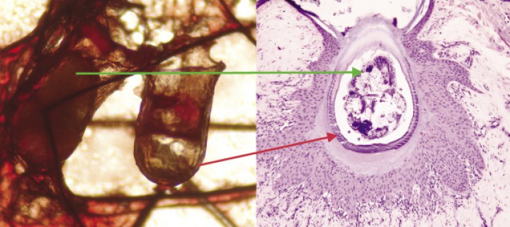 <p>Obsérvese la equivalencia de las estructuras en el raspado y en la biopsia (Equivalencia gráfica realizada por Gustavo Ramirez. Histovet).</p>