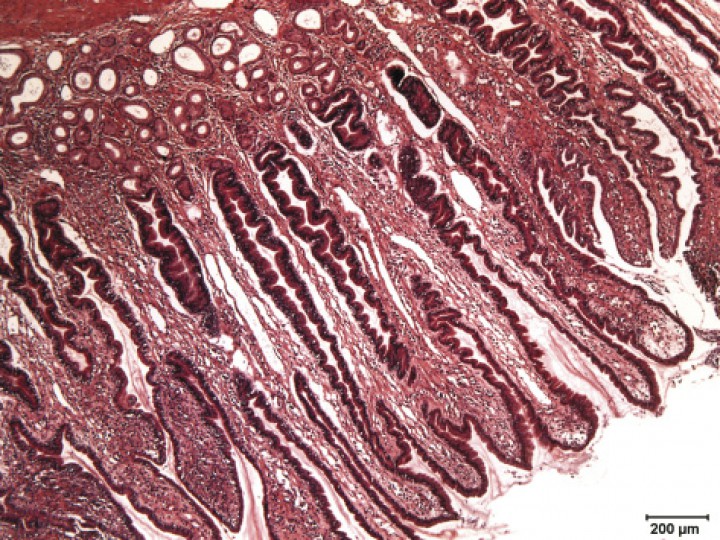 <div class=\"Basic-Text-Frame\">
<p>Imagen histopatológica de la mucosa gástrica de la zona pilórica donde se visualiza un gran desarrollo de la mucosa superficial y del cuello de las glándulas, lo que hace que las fosetas o criptas gástricas se observen más profundas. (Hematoxilina-Eosina x5).</p>
</div>