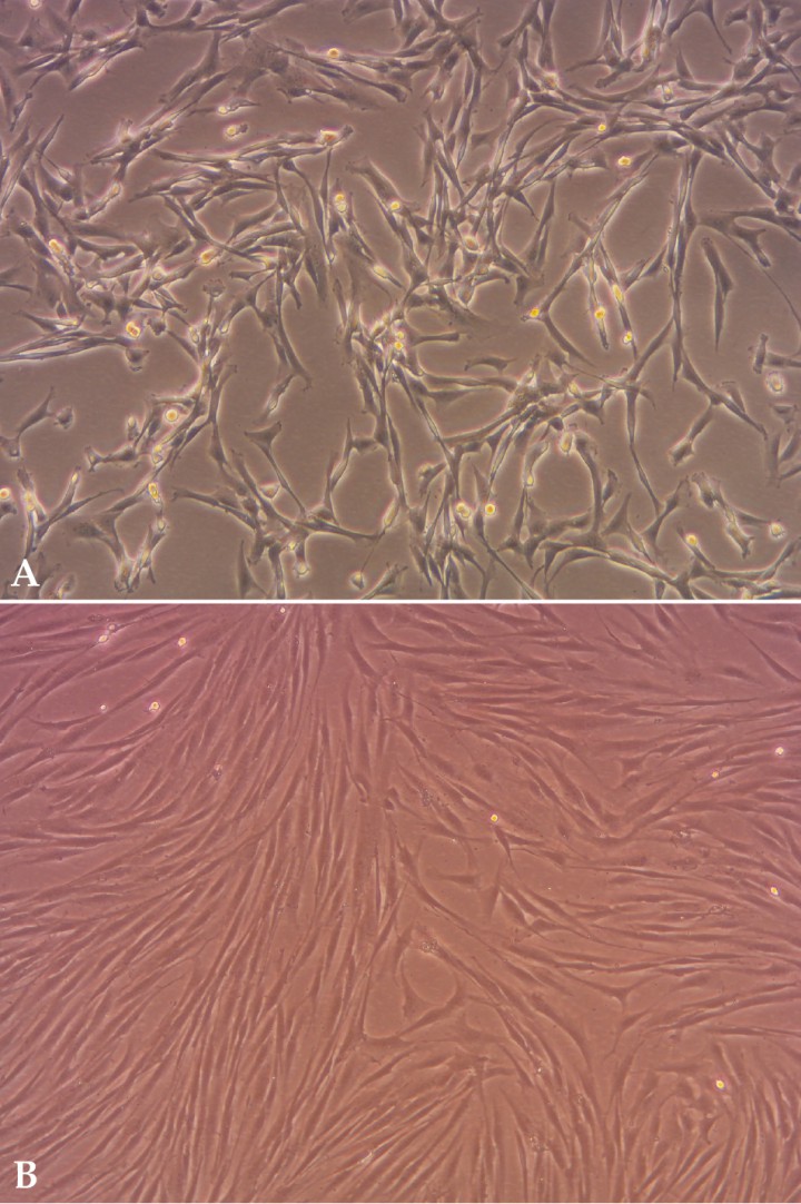 <p>Cultivos primarios de células madre mesenquimales caninas procedentes de tejido adiposo (A) y médula ósea (B). Nótese la morfología típicamente fusiforme.</p>