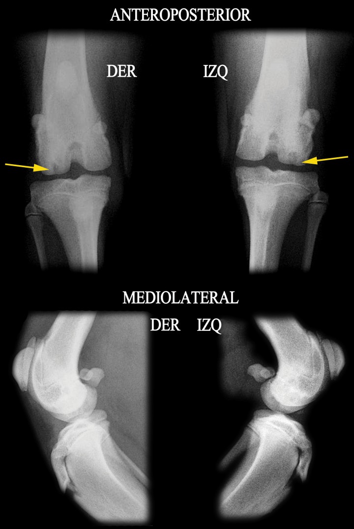 <p>Detalle de las radiografías anteroposterior y mediolateral, donde se muestra la lesión (flechas amarillas) (DER: Derecha, IZQ: Izquierda).</p>