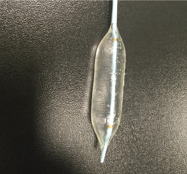 <p>Balón dilatador.</p>