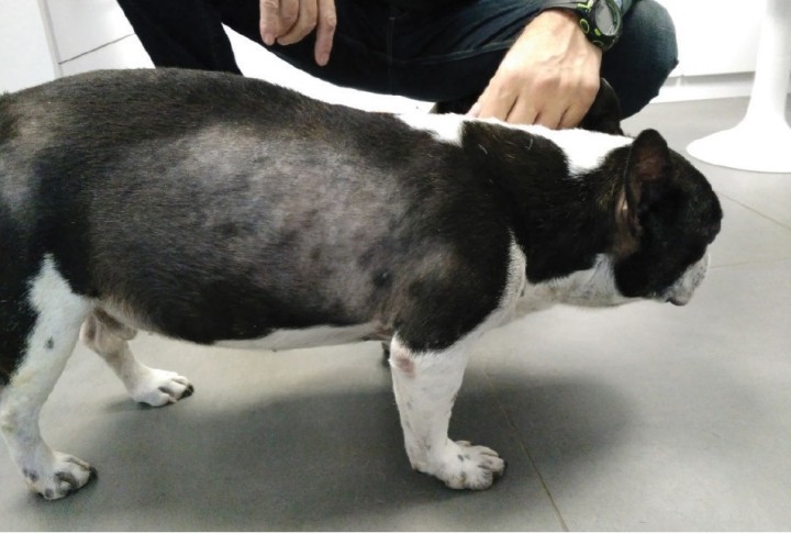 <p>Aspecto del abdomen en la primera consulta, compatible con ascitis.</p>