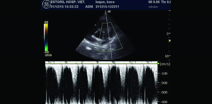 <p>Doppler pulsado arteria pulmonar, flujo acelerado postobstrucción.</p>