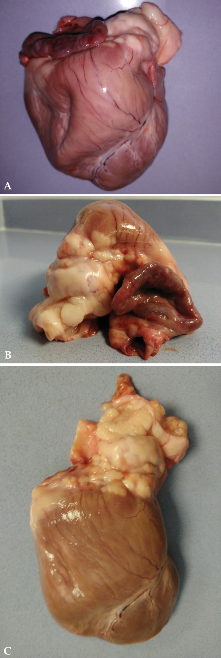 <p>(A) Aspecto macroscópico del corazón completo, vista lateral izquierda. Se observa una severa dilatación de ventrículo derecho. (B) Aspecto macroscópico del corazón completo, vista dorsal. Tumor en base cardíaca de gran tamaño, con invasión local. (C) Aspecto macroscópico del corazón completo, vista lateral derecha. Severa dilatación de ventrículo derecho y tumor en base cardíaca de gran tamaño con invasión local.</p>