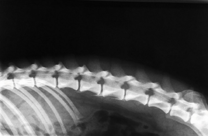 <p>Radiografía de contraste del catéter epidural llevado hasta L1-L2.</p>