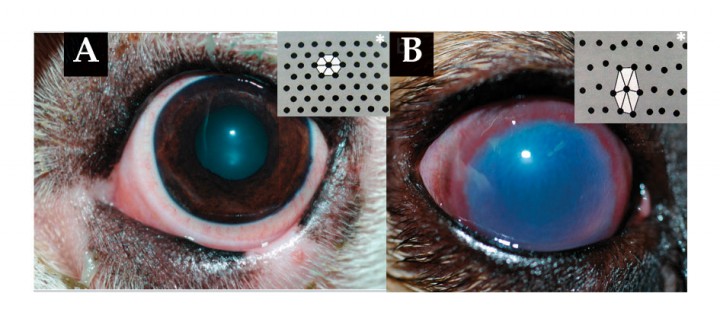 <p>(A) La transparencia corneal depende en gran medida de la disposición de las fibras de colágeno del estroma (*). (B) En los edemas corneales, el estroma se hidrata y las fibras de colágeno se engrosan y pierden su equidistancia, produciendo un aspecto azulado característico.</p>