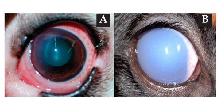 <p>(A) Las lesiones de origen epitelial suelen dar lugar a edemas localizados. (B) Los edemas de origen endotelial suelen ser difusos.</p>