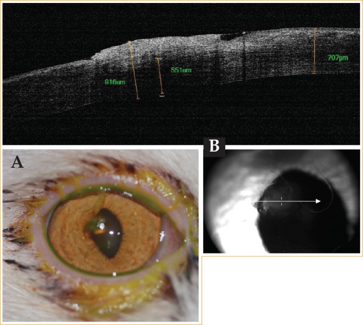 <p>(A) Imagen del ojo derecho el día de la primera visita. (B) OCT del ojo derecho el día de la primera visita.</p>