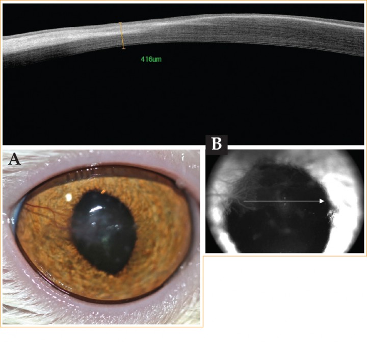 <p>(A) Imagen del ojo derecho tras 8 se­manas de postoperatorio. (B) OCT del ojo derecho tras 8 se­manas de postoperatorio.</p>