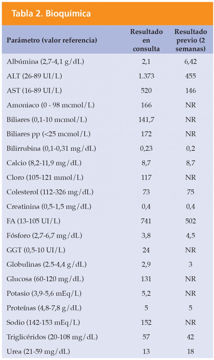 <p>ALT alanina aminotransferasa; AST aspartato aminotransferasa; FA fosfatasa alcalina; GGT -glutamil transpeptidasa.</p>