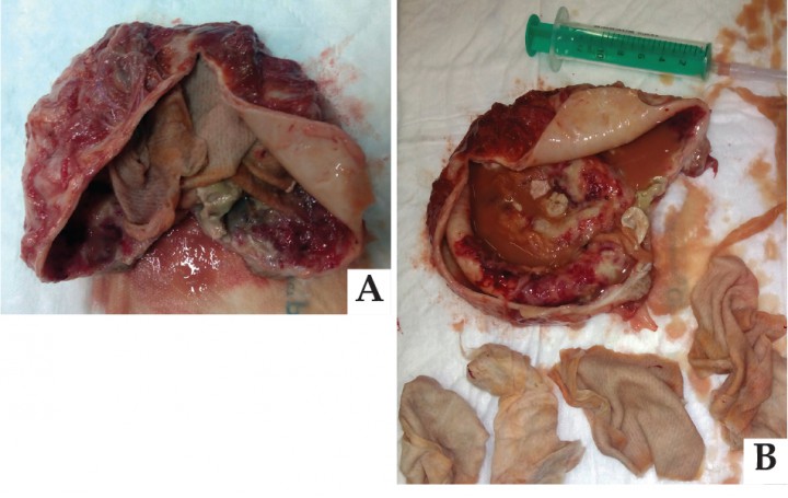 <p>(A y B) Imágenes macroscópicas durante la necropsia en las que se observa la cápsula del absceso en cuyo interior se encontraron gasas quirúrgicas y contenido líquido purulento.</p>