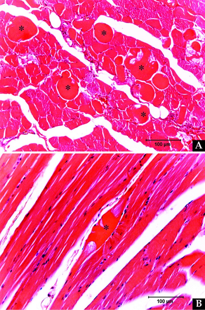 <p>Biopsy specimens of the diaphragmatic musculature show mild to moderate multifocal segmental myofiber degeneration/necrosis. Changes observed in the abnormal myofibers (*) visualized in (A) transversal section and (B) longitudinal section include myofiber swelling, loss of cross striations and lack of normal cylindrical morphology.</p>