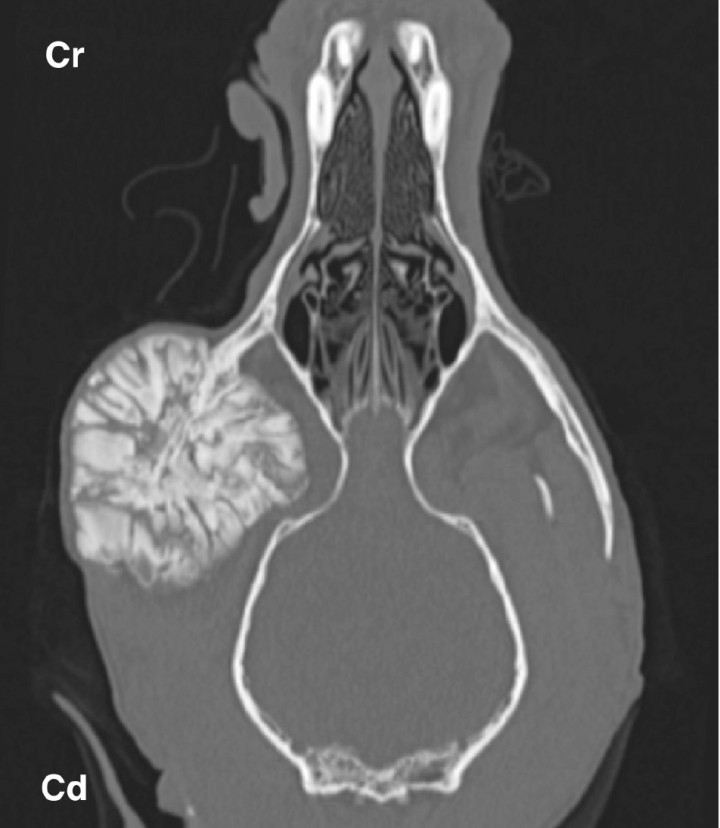 <p>Multilobular tumor of bone in an 8 year-old mixed breed dog. Dorsal bone window image of a head show a large, coarse, mineral attenuated mass with well defined margins at the level of the right zygomatic arc. Cr: cranial. Cd: caudal.</p>