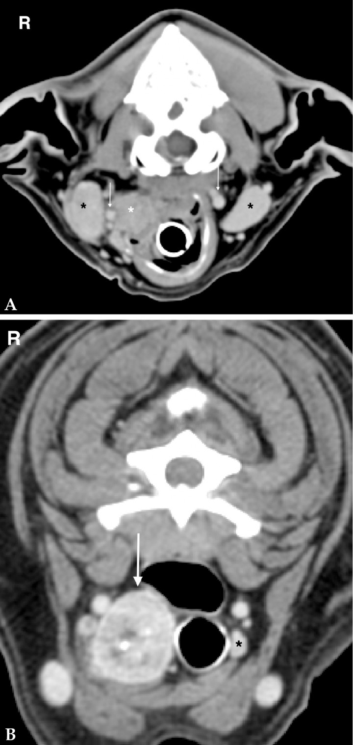 <p>(A) 8 year-old Golden Retriever with a carotid body tumour on the right side. Transverse CT soft tissue window post contrast image of the neck at the level of the carotid bifurcation (white arrows) and mandibular salivary glands (black asterisks). There is a poorly demarcated mass (white asterisk) with mild heterogeneous contrast enhancement on the right dorsolateral aspect of the larynx causing lateral displacement of the right carotid arteries. (B) Transverse soft tissue window post contrast image of the neck of a 13 year-old mixed breed dog with a mass at the level of the right thyroid gland (white arrow). The mass shows marked heterogeneous contrast enhancement and a central pinpoint mineralization. The left thyroid gland is unremarkable (black asterisk). R: right.</p>