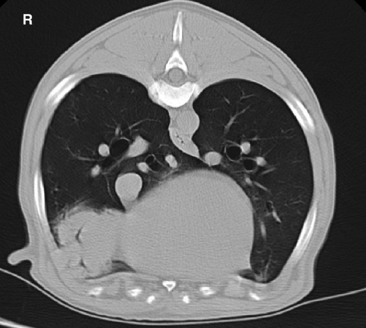 <p>10 year-old Bernese Mountain dog with a well demarcated bronchocentric soft tissue attenuating mass in the right middle lung lobe. CT features are consistent with histiocytic sarcoma. R: right.</p>