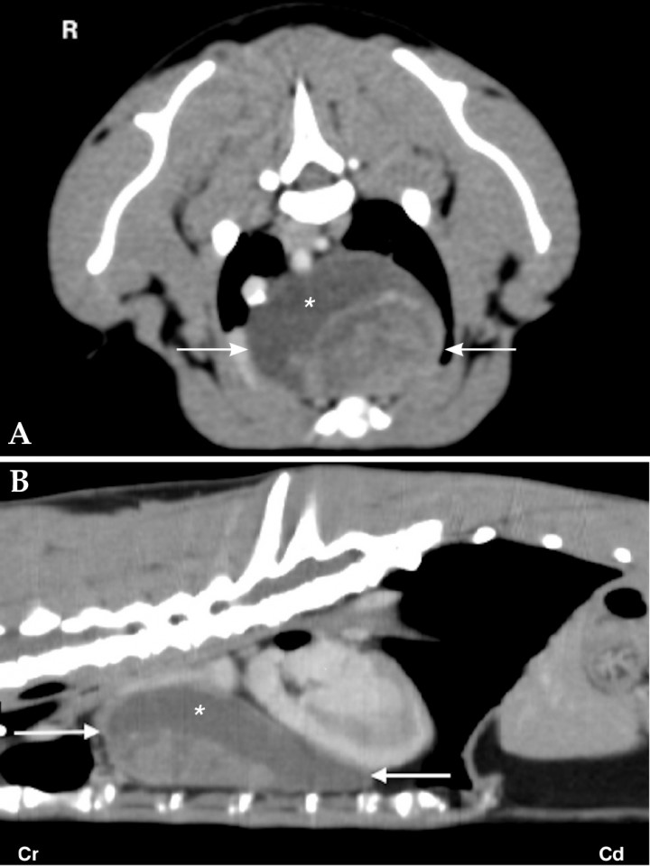 <p>(A) Transverse and (B) dorsal reformatted soft tissue window post contrast images of a 6 year-old European Shorthair cat. At the level of the cranioventral mediastinum there is a large, mildly heterogenous contrast enhancing mass (white arrow) with a large cystic area (white asterisk) causing displacement of vascular cranial mediastinal structures to the right and dorsal and caudal displacement of the cardiac silhouette. The mass was consistent with a thymoma. R: right. Cr: cranial. Cd: caudal.</p>