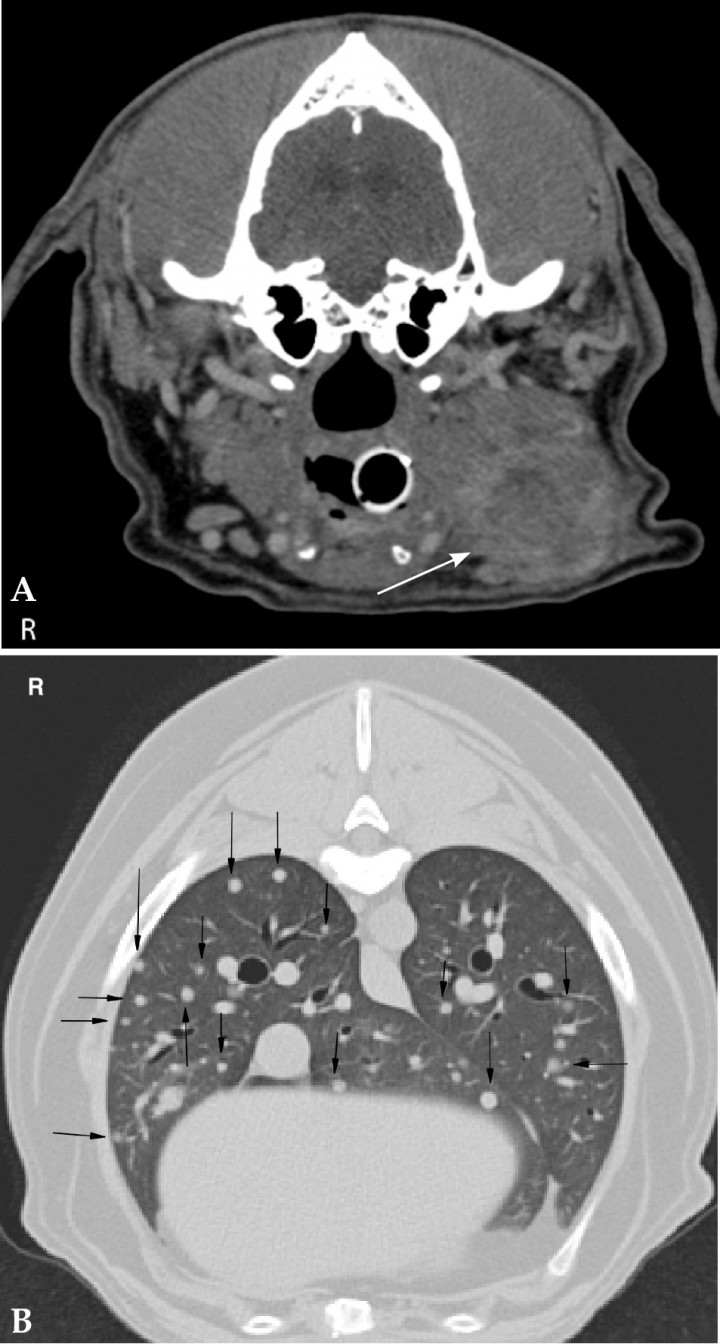 <p>(A) Transverse soft tissue window post contrast image of the neck of a 10 year-old Golden Retriever. The left mandibular lymph nodes are severely enlarged with indistinct margins and heterogeneous contrast enhancement (white arrow). Fine aspiration of the lymph node revealed metastasis of a squamous cell carcinoma of the nasal cavity. (B) Transverse lung window post contrast image of an 11 year-old Puggle with an oral melanoma. There are multiple, different sized, regularly marginated, soft tissue nodules throughout the whole lung parenchyma consistent with pulmonary metastasis (black arrows). R: right.</p>