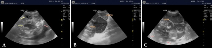 <p>Imágenes de ecografía abdominal. (A) Se observa una masa de ecotextura heterogénea, bordes irregulares, sin aparente órgano-dependencia. Muestra zonas hiperecogénicas (flecha roja) de distribución aleatoria por el parénquima. Se aprecian, además, zonas hipoecoicas compatibles con contenido líquido (flechas amarillas). (B) Se aprecia el riñón izquierdo comprimido por la masa, y rodeado por la cápsula de la misma. Se puede observar edema subcapsular del riñón. (C) La zona craneal de la masa muestra un parénquima hipoecoico heterogéneo, sugestivo de consistencia líquida (zona superior), dividido en compartimentos por posible tejido fibroso. Se observan zonas que proyectan sombra acústica (flechas rojas) compatibles con calcificaciones.</p>