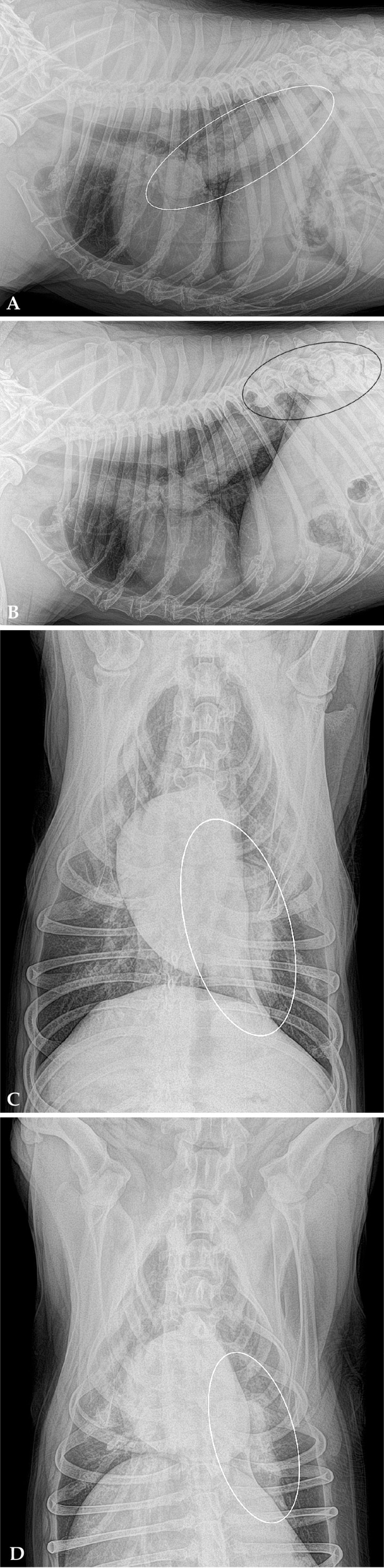 <div>
<p>Mismas imágenes que la Figura 1. Se observa una masa de opacidad tejido blando cilíndrica de márgenes irregulares en el lóbulo caudal izquierdo, extendiéndose desde la carina hacia caudodorsal (área delimitada en blanco). El área negra señala la espondilosis severa en T11, T12, T13, L1.</p>
</div>