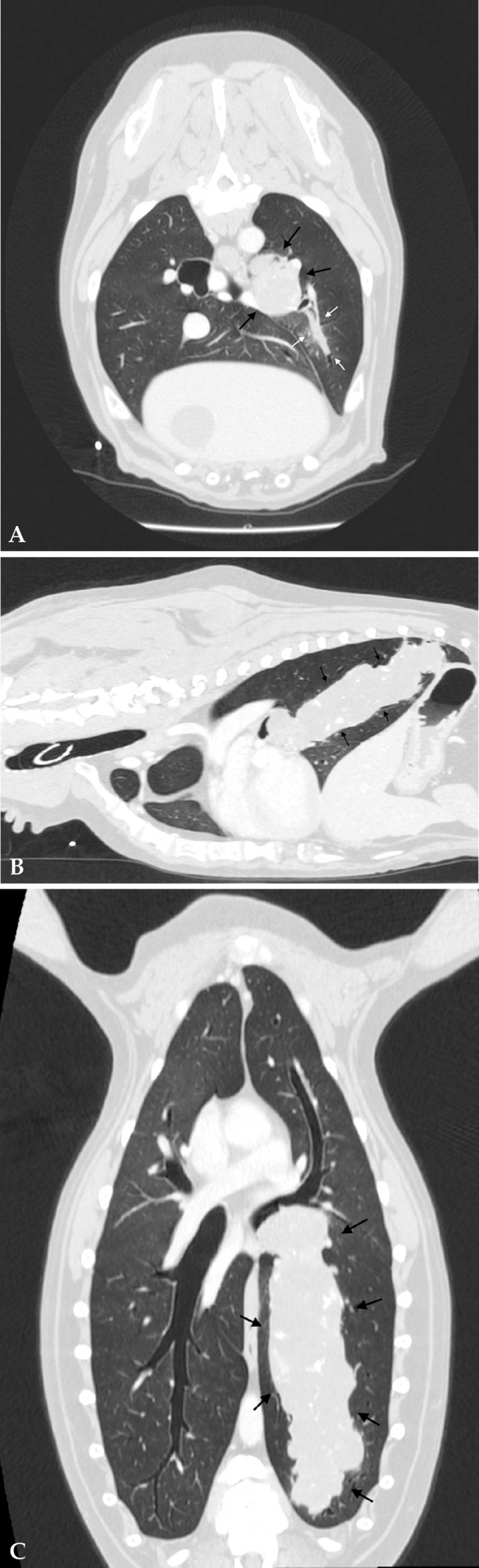 <p>Imágenes de TC de tórax en ventana de pulmón postcontraste. (A) Plano axial. (B) Plano sagital. (C) Plano dorsal. La luz del bronquio caudal izquierdo se encuentra prácticamente obstruida por una masa isoatenuante con mineralización distrófica y cilíndrica (flechas negras) que se extiende hacia bronquiolos secundarios (flechas blancas). La captación de contraste intravenoso es pobre y heterogénea.</p>