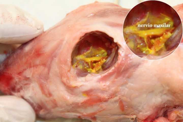 <p>Disección de la cabeza de un conejo New Zealand White después del bloqueo del nervio maxilar utilizando un colorante de tejido con un volumen de 0,25 ml. Nótese el nervio maxilar totalmente teñido.</p>