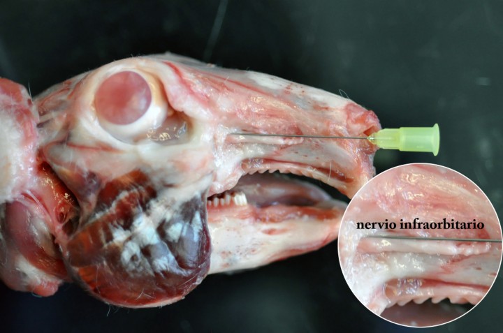 <p>Disección de la cabeza de un conejo New Zealand White. Nótese el nervio infraorbitario saliendo del foramen infraorbitario en dirección rostral. Nótese también el tamaño del nervio que dificulta la introducción de una aguja sin dañar el nervio.</p>