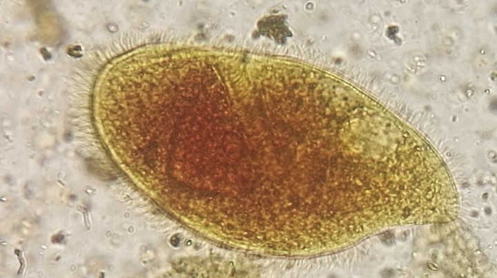 <p>Imagen de trofozoíto de <em>Nyctotheroides kyphodes</em> (Lugol, 100 x).</p>