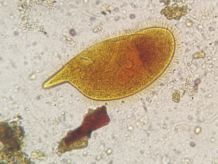 <p>Imagen de trofozoíto de <em>Nyctotheroides teleacus</em> (Lugol, 100 x).</p>