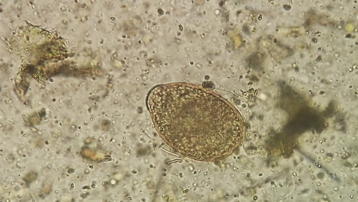 <p>Imagen de quiste de <em>Nyctotheroides</em> sp. (Lugol, 100 x).</p>