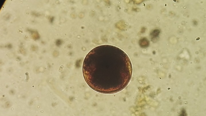 <p>Imagen de quiste de <em>Balantidium</em> sp. (Lugol, 100 x).</p>