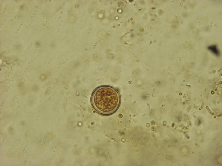 <p>Imagen de quiste de <em>Entamoeba insolita</em> (Lugol, 100 x).</p>