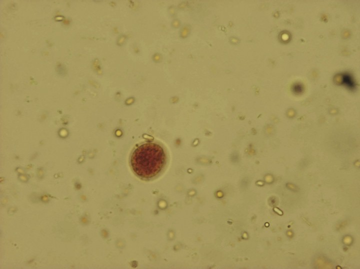 <p>Imagen de quiste de <em>Entamoeba</em> sp. de 4 núcleos “no <em>insolita</em>” (Lugol, 100 x).</p>