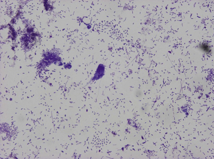 <div class=\"Basic-Text-Frame\">
<p>Imagen de <em>Trichomitus</em> sp. (Giemsa, 100 x ampliada, 3 flagelos anteriores libres y 1 recurrente).</p>
</div>