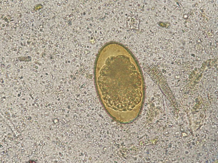 <p>Imagen de huevo de oxiúrido (Lugol, 40 x).</p>