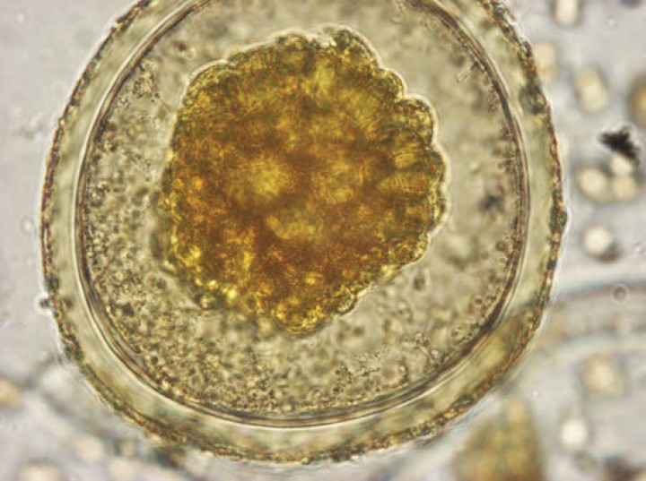 <p>Imagen de huevo de ascárido (Lugol, 100 x).</p>