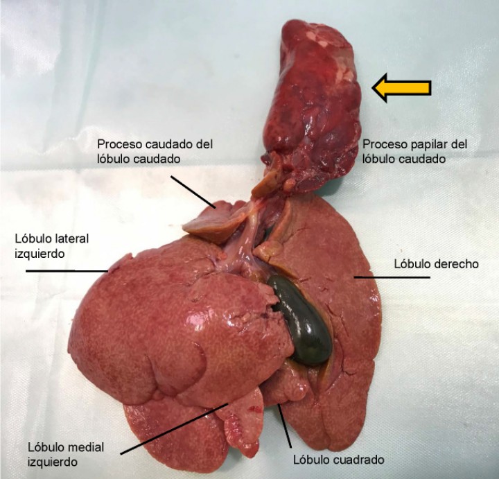 <p>Aspecto de la cara visceral de hígado con TLH de lóbulo caudado en un conejo. Se observa la torsión presente en el proceso papilar del lóbulo caudado, desplazado dorsalmente (flecha amarilla). Identificamos lóbulo hepático derecho e izquierdo. Lóbulo derecho: presencia de lóbulo cuadrado caudal a la vesícula y presencia de lóbulo caudado con dos procesos, caudado y papilar.</p>