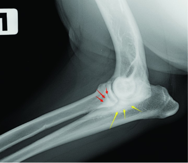 <p>Radiografía lateral de un Labrador de 11 meses donde se observa una marcada esclerosis subtroclear (flechas amarillas) y difuminación del borde del proceso coronoideo (flechas rojas) indicativas de enfermedad del compartimento medial.</p>