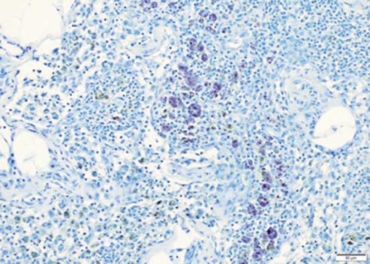 <p>Biopsia de linfonodo con la tinción de azul de toluidina, donde se identifican algunos mastocitos. 20x. Imagen cortesía de laboratorios IDEXX.</p>
