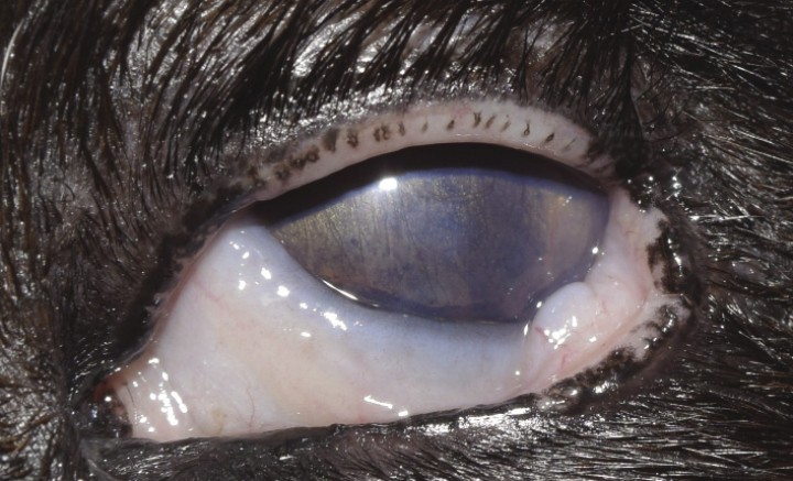 <p>Neovascularización corneal e iris bombé en OS.</p>