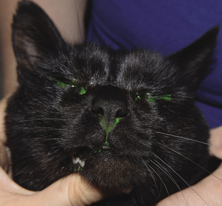 <p>Test de Jones positivo.</p>