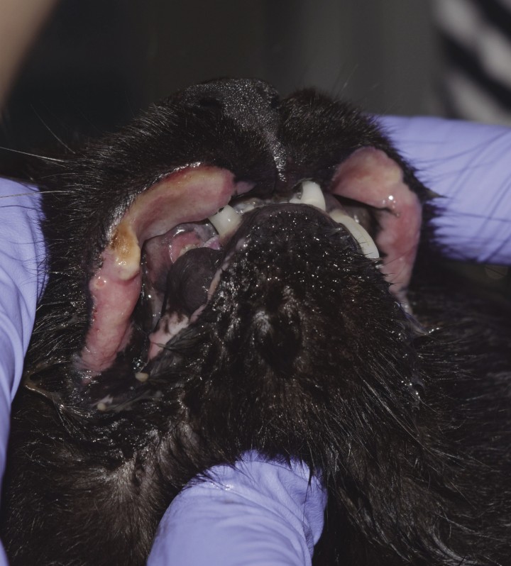 <p>Úlceras indolentes en labios superiores y fractura del canino superior derecho.</p>