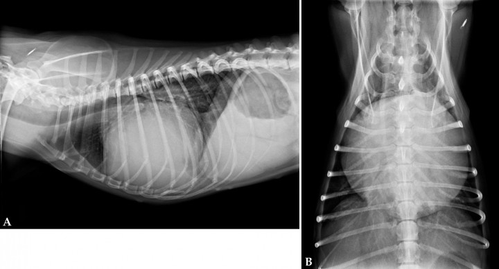 <p>Radiografías de tórax de un paciente que se presenta con episodio de pérdida del tono postural con relajación de esfínteres. (<strong>A</strong>) Proyección lateral derecha. (<strong>B</strong>) Proyección ventrodorsal.</p>
