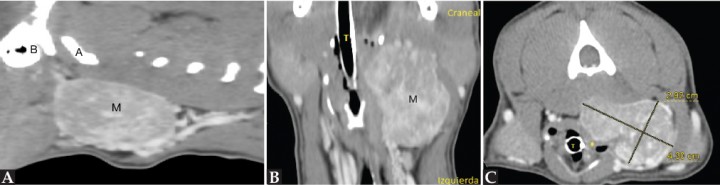 <p>Imágenes de TC poscontraste en ventana de tejido blando de la masa cervical izquierda. (<strong>A</strong>) Plano sagital. (<strong>B</strong>) Plano dorsal. (<strong>C</strong>) Plano transversal. Nótese el desplazamiento de la laringe (*). M: masa; A: atlas; B: bulla timpánica izquierda.</p>