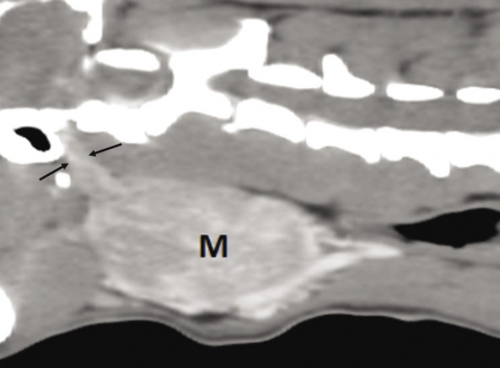 <p>Sección sagital oblicua en ventana de tejido blando poscontraste. Nótese la extensión de la masa (M) hacia la base del cráneo (entre flechas).</p>