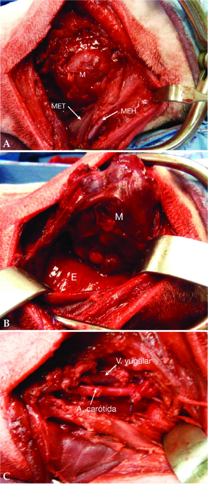 <p>Imágenes intraquirúrgicas. (<strong>A</strong>) Retracción de los músculos esternohioideos (MEH) y esternotiroideos (MET) para permitir la observación de la masa (M) orientada craneal a la derecha y caudal a la izquierda. (<strong>B</strong>) Se aprecia la masa (M) tras reclinar el esófago (E). (<strong>C</strong>) Se puede observar la arteria carótida y vena yugular tras la extracción de la masa.</p>